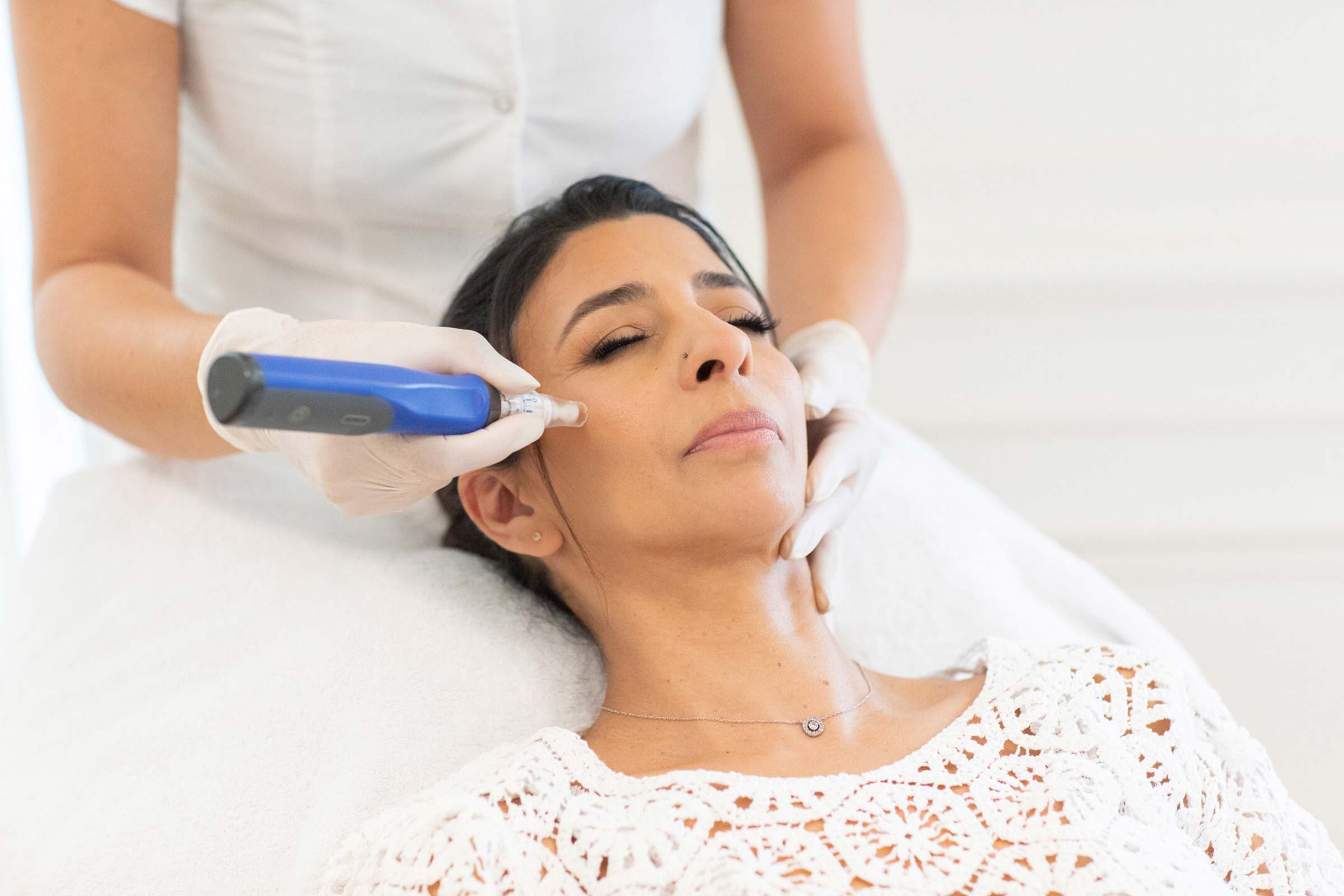 Microneedling à Lyon